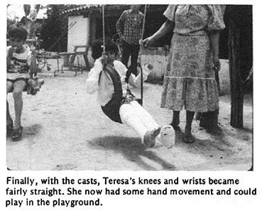 Finally, with the casts, Teresa's knees and wrists became fairly straight. She now had some hand movement and could play in the playground.