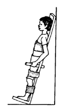 Strapping the child to a 'standing board'.