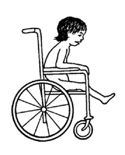 A child with weak hips or back, from spinal cord injury, spina bifida, or severe polio.