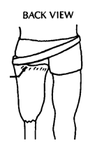 Above-knee artificial limbs (Back view)