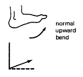 Normal upward bend