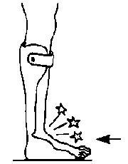 The upward flexibility of the braces caused pain inside the ankle and mid-foot.