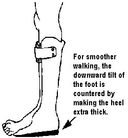 For smoother walking, the downward tilt of the foot is countered by making the heel extra thick.