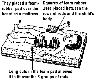 They placed a foam-rubber pad over the board as a mattress. Squares of foam rubber were placed between the rows of rods and the child's body. Long cuts in the foam pad allowed it to fit over the 3 groups of rods.