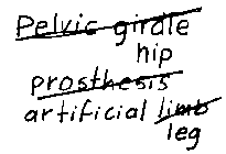 Use "hip" instead of "pelvic girdle" and use "artificial leg" instead of "prosthesis leg".